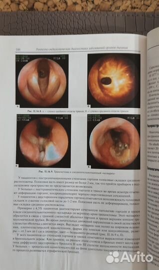 Медицинская литература по эндоскопии