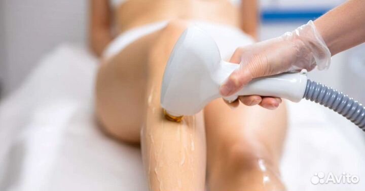 Лазерная эпиляция