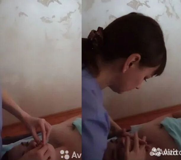 Лечебный массаж (детский, взрослый), хиджама