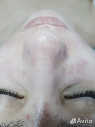 Косметолог Эльвира