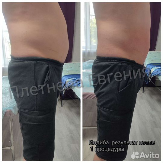 Консультация нутрициолога