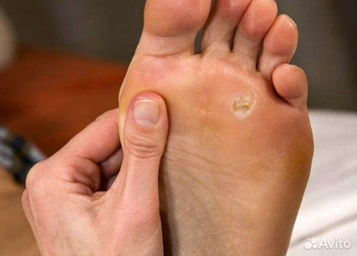 Педикюр, подолог Колтуши, Всеволожский район