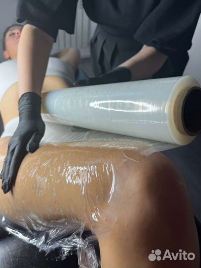 Карамельная липосакция