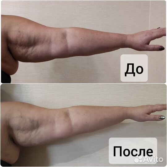 Массаж коррекции фигуры акция