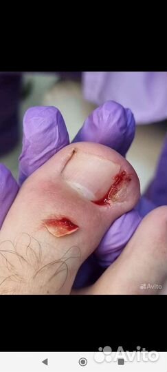 Педикюр,маникюр,подолог,выезд на дом