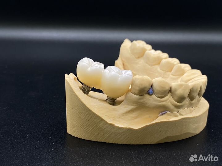 Услуги фрезерного центра полного цикла по stl файл