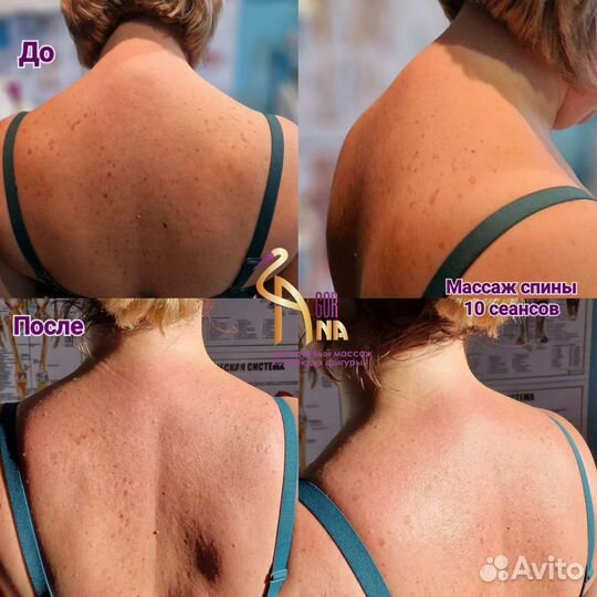 Массаж, коррекция фигуры, кавитация, вакуумный