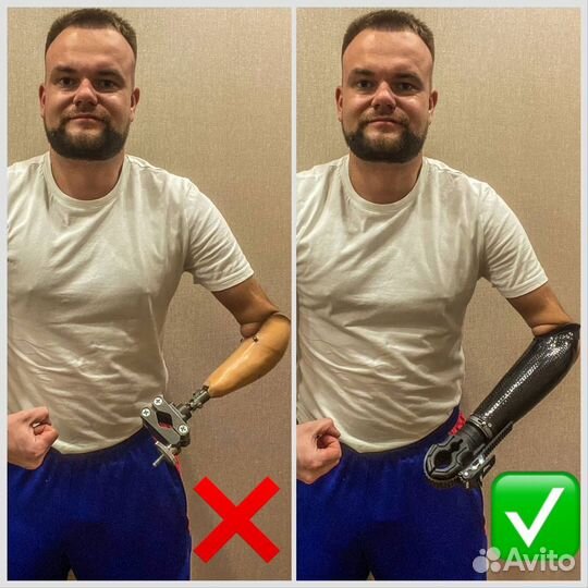 Твой личный ассистент протезирования