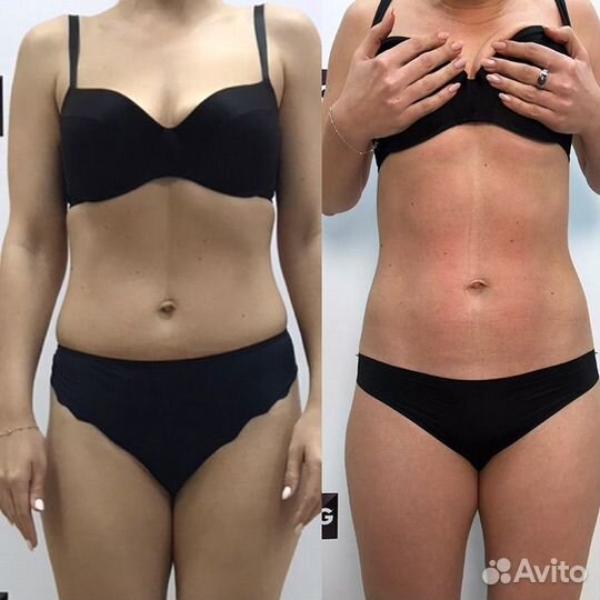 Антицеллюлитный массаж с эффектом сразу