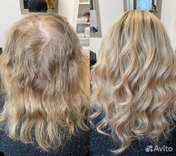 Накладка на волосы