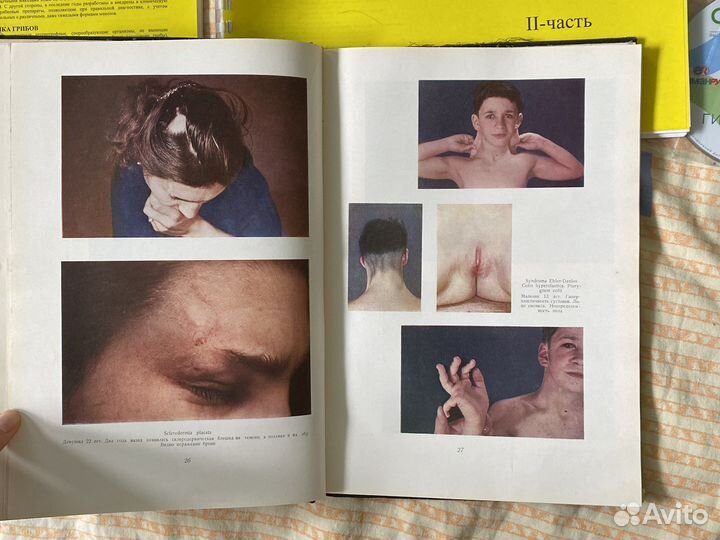 Книги по дерматологии