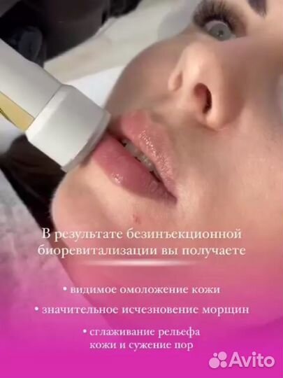 Чистка лица, плазмолифтинг, биоревитализация