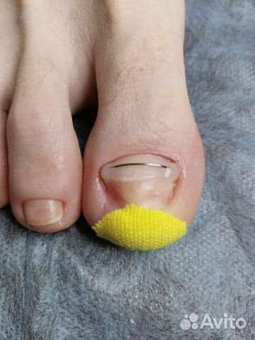 Подолог Педикюр