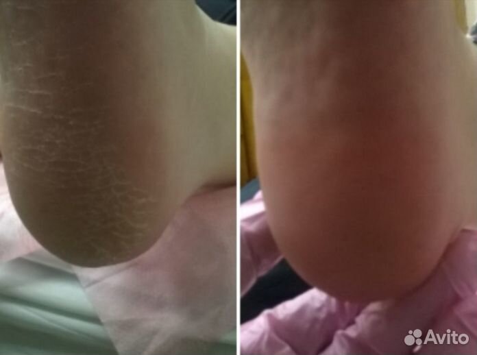 Аппаратный маникюр