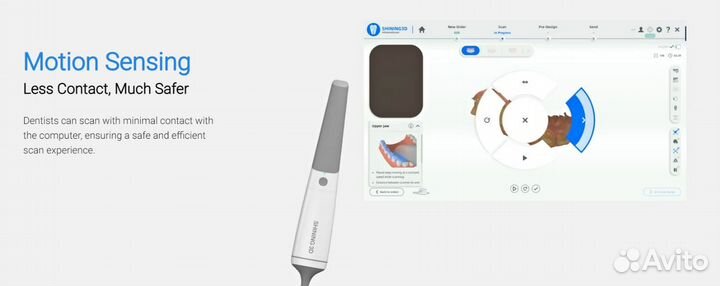 Сканер интраоральный Shining3d Aoralscan 3