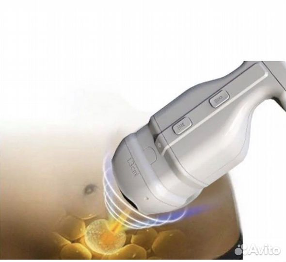 Липосакция без операции. Liposonix