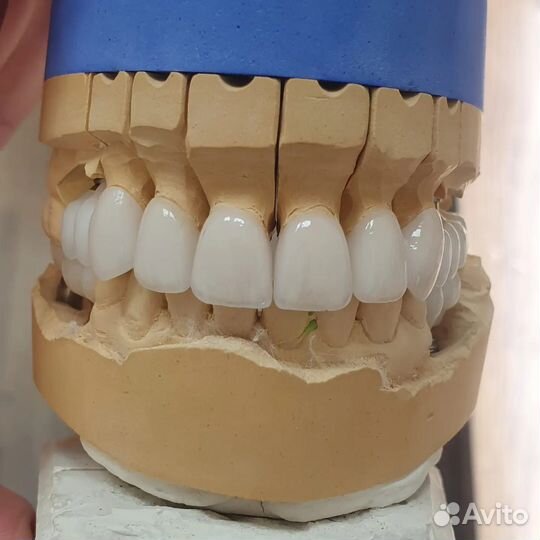 Зубной техник керамист