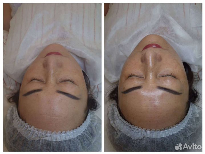 Услуги косметолога