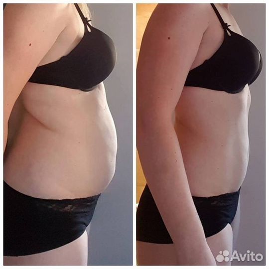 Аппаратная коррекция фигуры