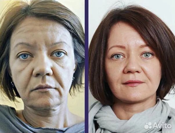 Массаж лица