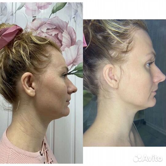 Массаж Горелово