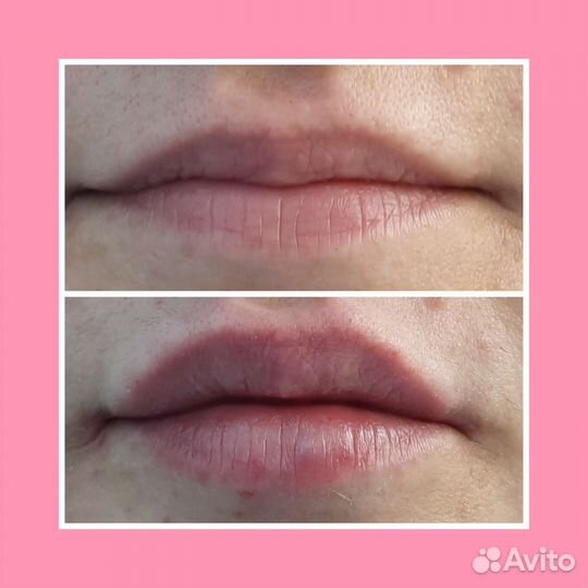 Услуги косметолога