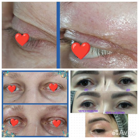 Косметолог эстетист