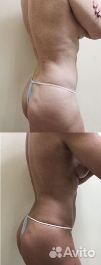 Моментальный загар