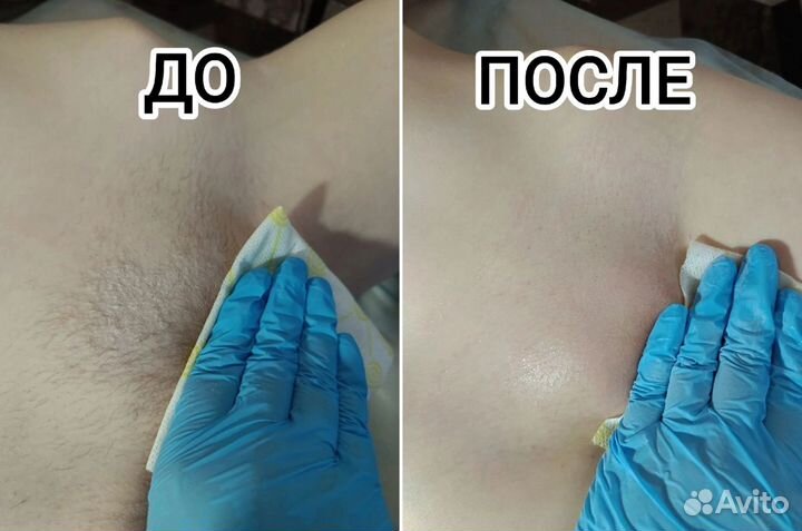 Ваксинг, шугаринг, гелинг, SPA- депиляция