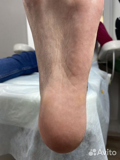 Смарт -педикюр