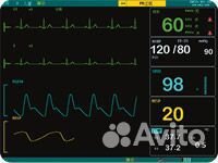 Монитор пациента Kernel KN-601M экран LCD 12,1