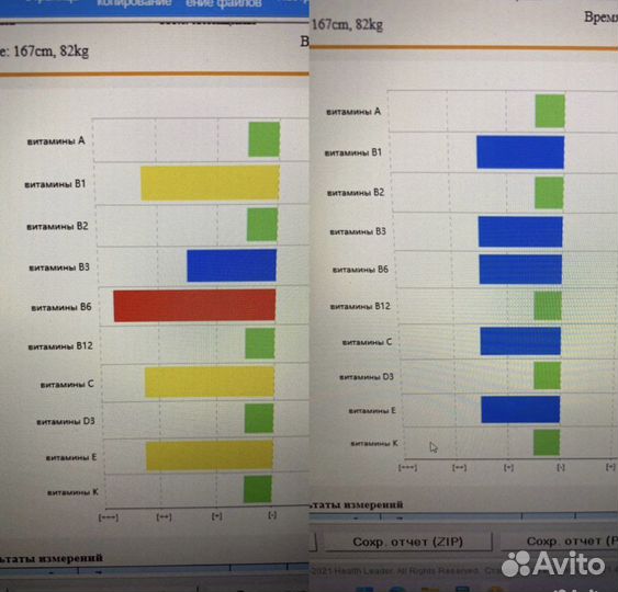 Диагностика брт с расшифровкой и рекомендациями