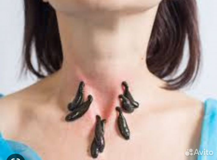 Пиявки из питомника