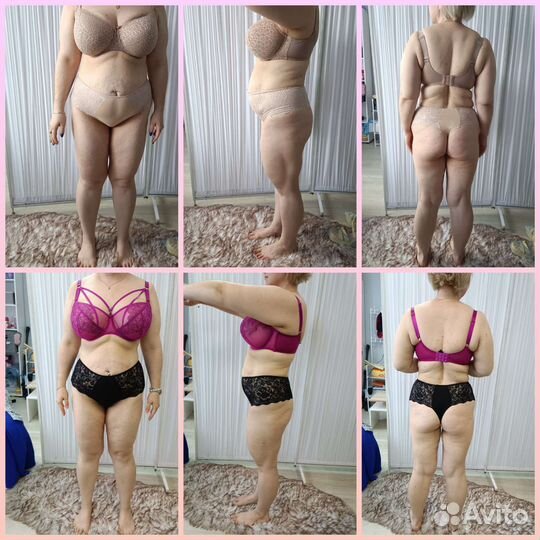 LPG. аппаратное удаление волос