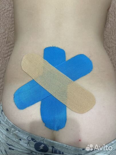 Тейпирование