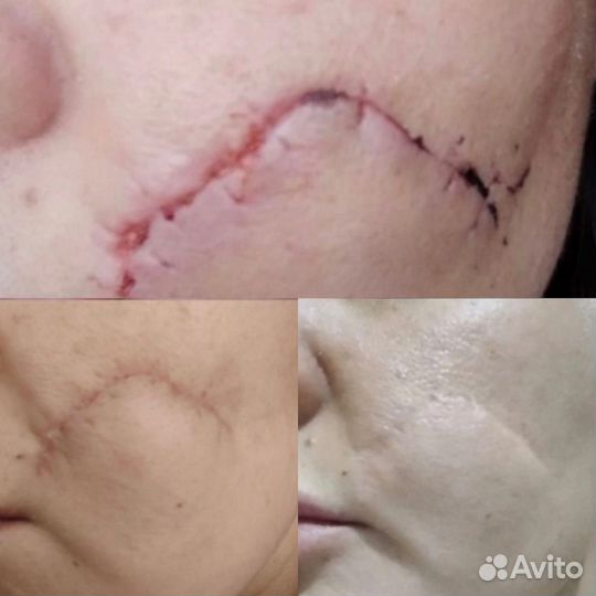 Холодная Плазма