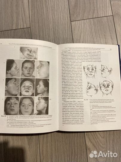 Книга по пластической хирургии Козин