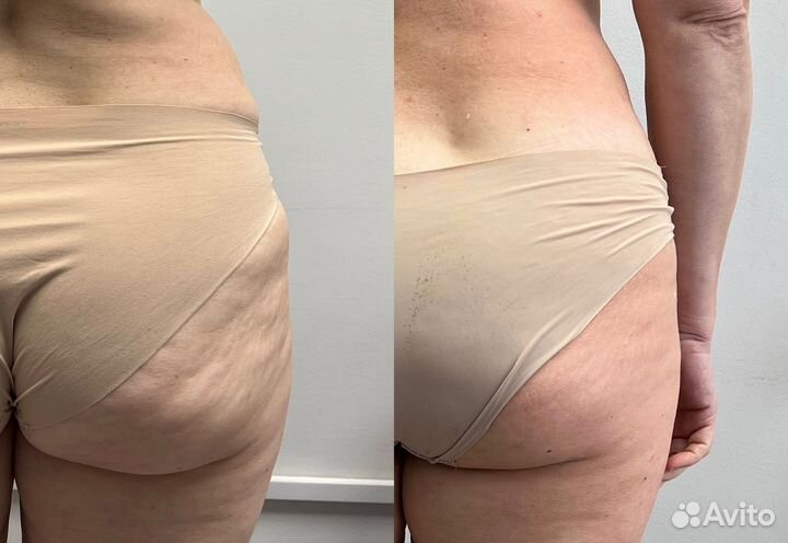 Модели на медовую выкатку