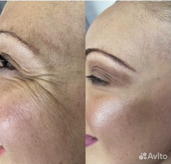 Модель на плоский бант губы обучение