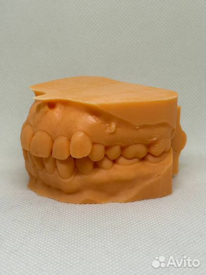 Фотополимерная (SLA) печать для ортодонтов