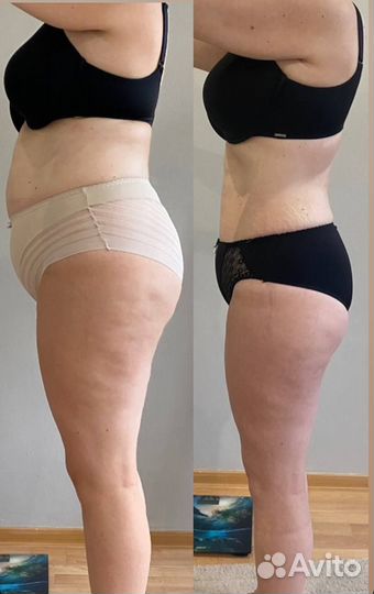 Коррекция фигуры