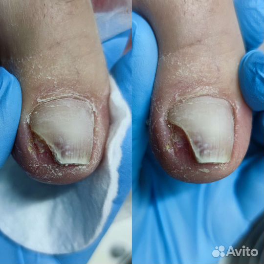 Подолог маникюр педикюр