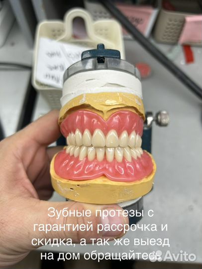 Зубные протезы