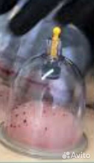 Массаж лица и тела