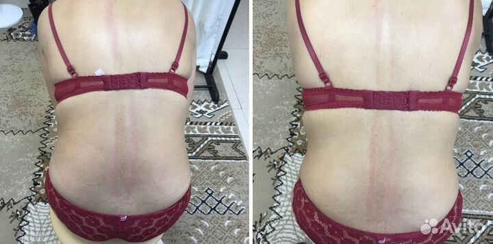 Мануальный массаж. Костоправ. Хиропрактик