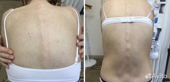 Мануальный массаж. Костоправ. Хиропрактик