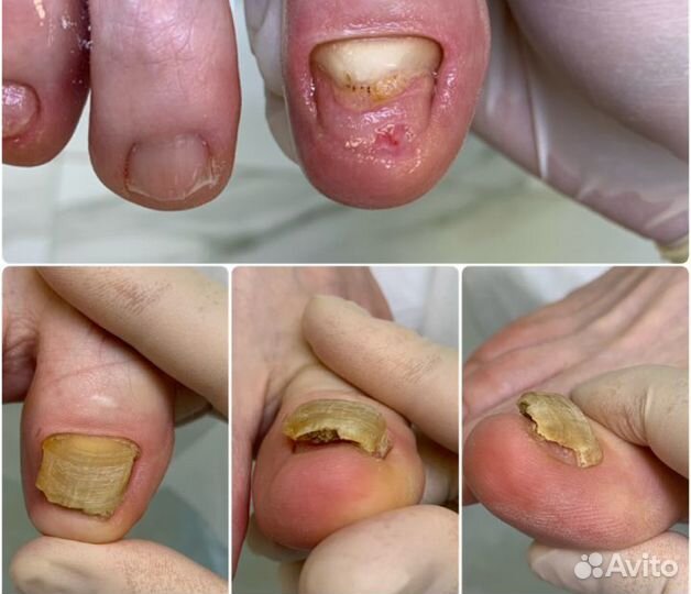 Подолог. Косметолог. Парикмахер. Маникюр Б. Козино