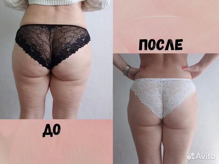 Массаж / Антицеллюлитный массаж / LPG – массаж