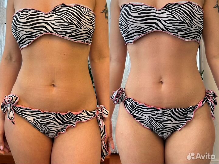 Коррекция фигуры Индиба Похудение