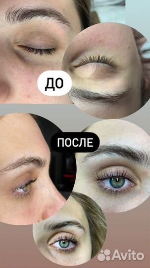 Ламинирование ресниц с ботоксом